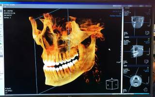 digital scan of skull