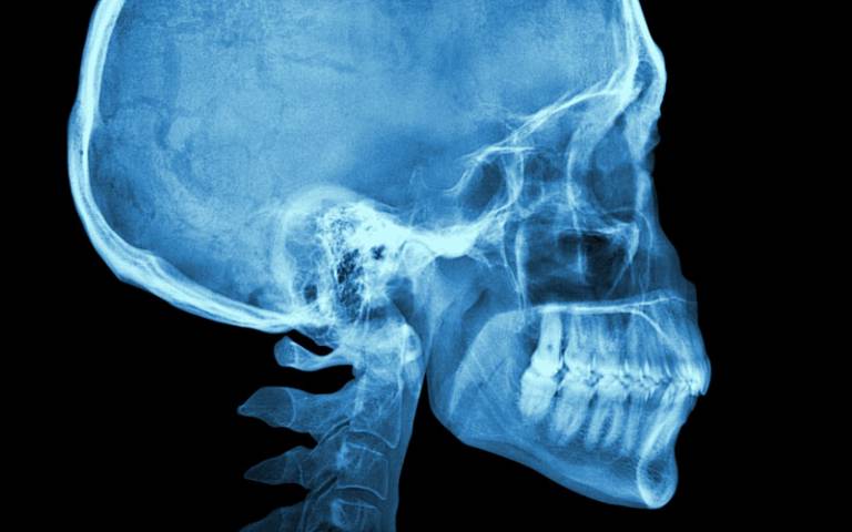Skull x-ray