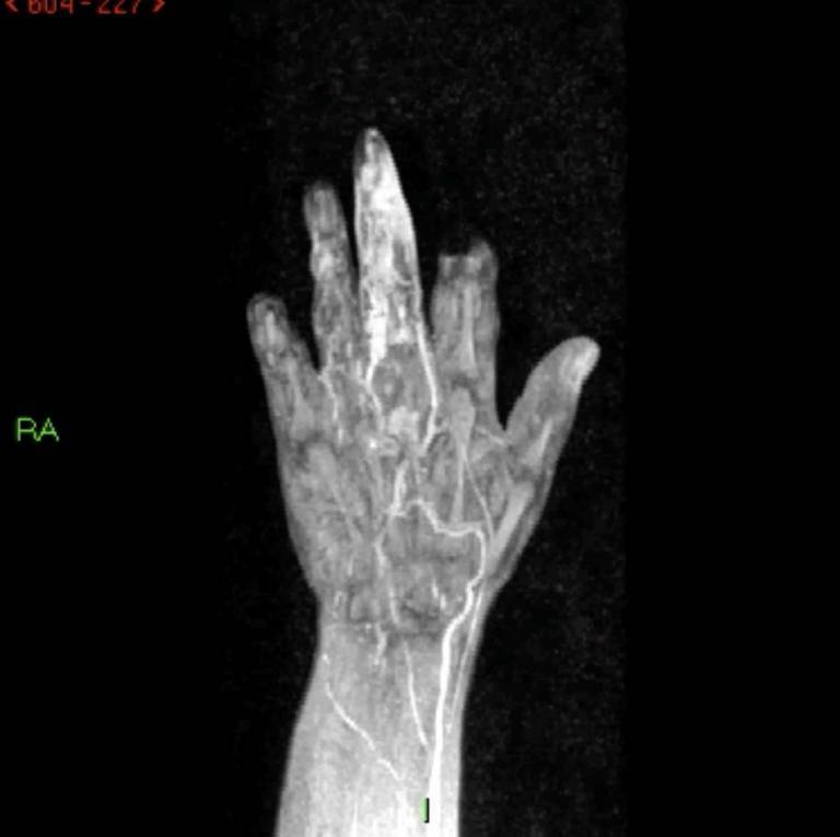 Computational image of a human hand 