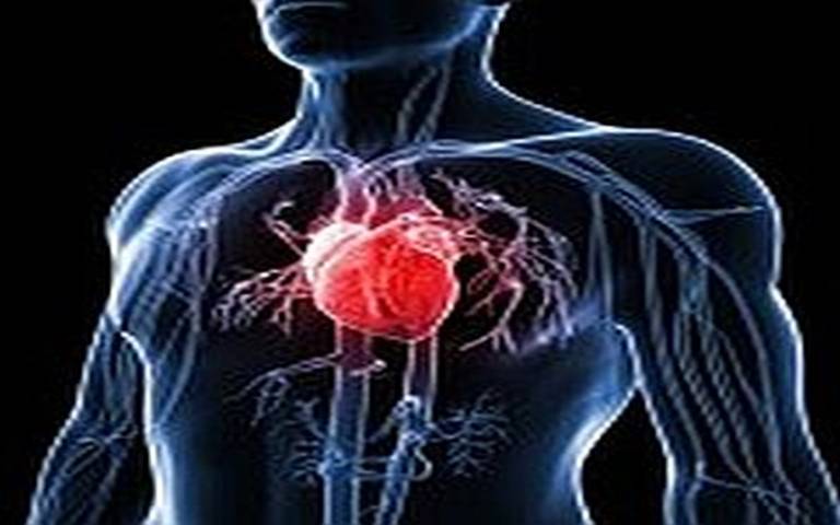 CVD heart