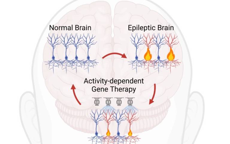 A cartoon image of a brain, demonstrating how gene therapy can help treat an epileptic brain