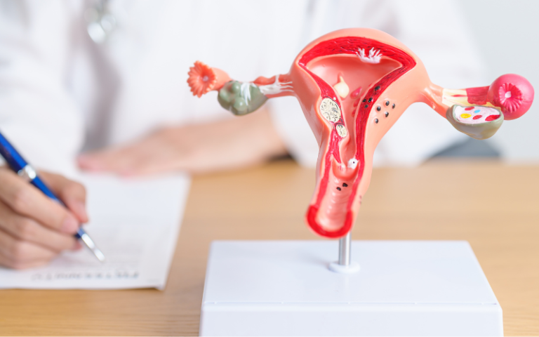 A photo of a doctor with a uterus and ovaries anatomy model