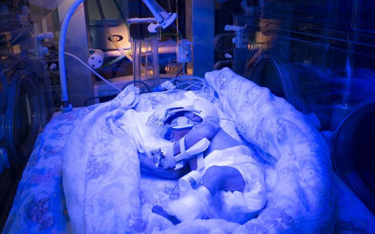 premature baby under UV