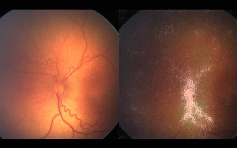 An image of a retinal scan.