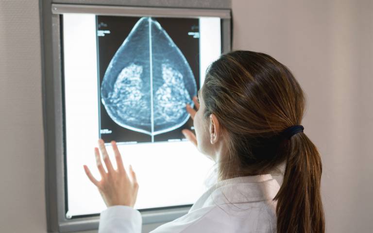 female doctor looking at a mammogram at the hospital