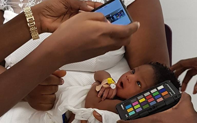 Newborn baby looking up at smartphone camera to test for jaundice