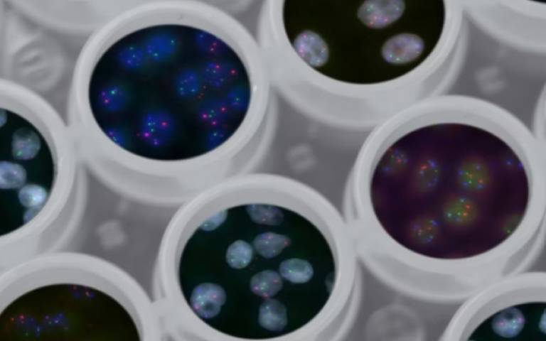 several petri dishes show magnified 'diseases' of different colours and shapes