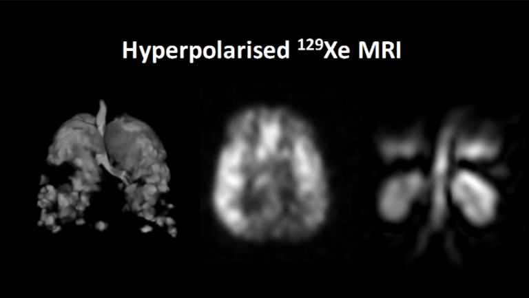 Hyperpolarised MRI