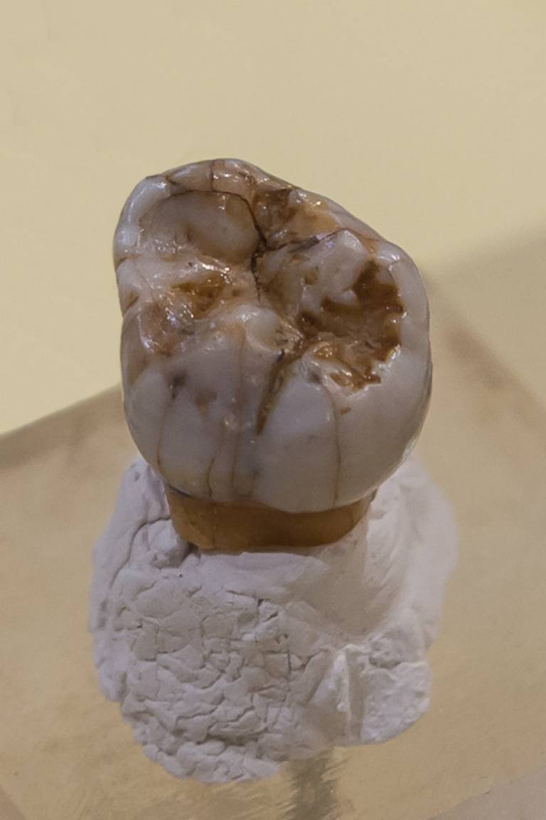 Denisovan 4 - Molar Tooth - Occlusal View