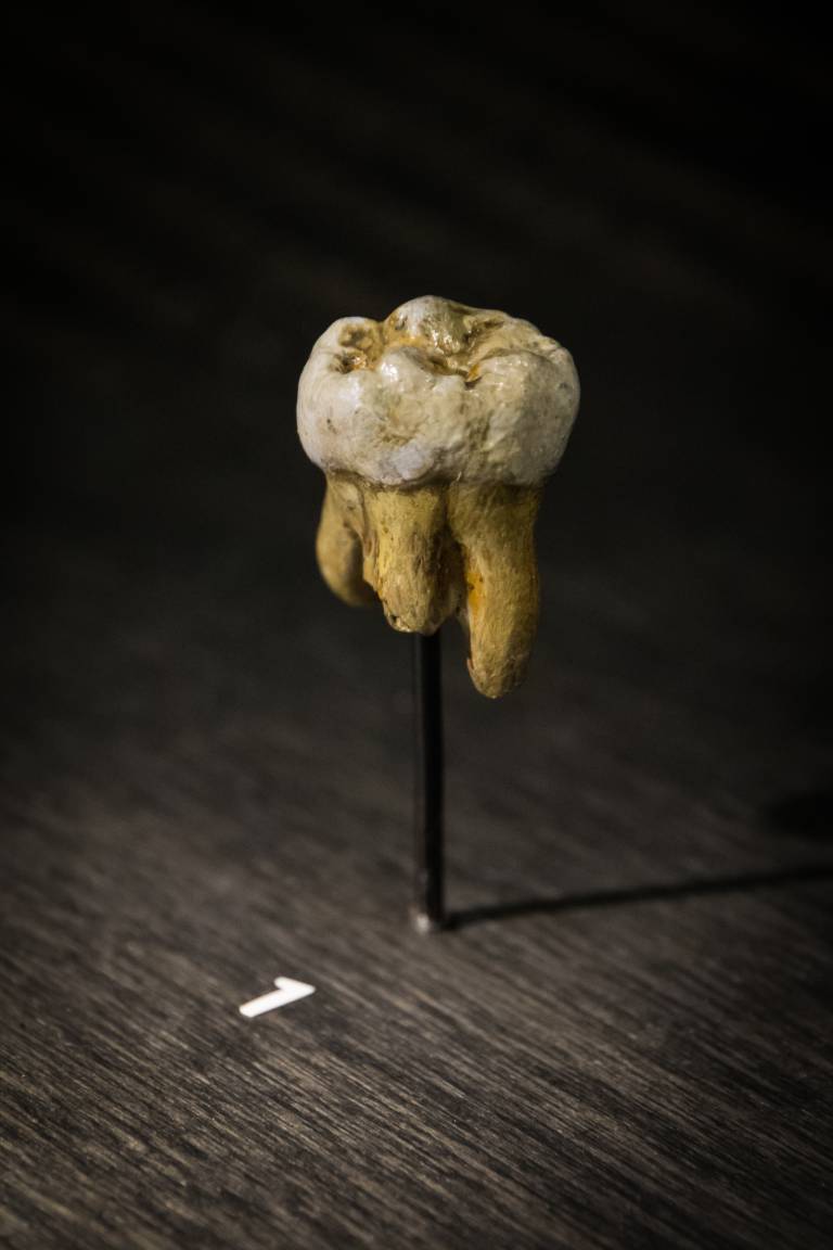 Denisovan Molar Tooth