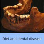 Diet and dental disease
