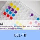 UCL-TB
