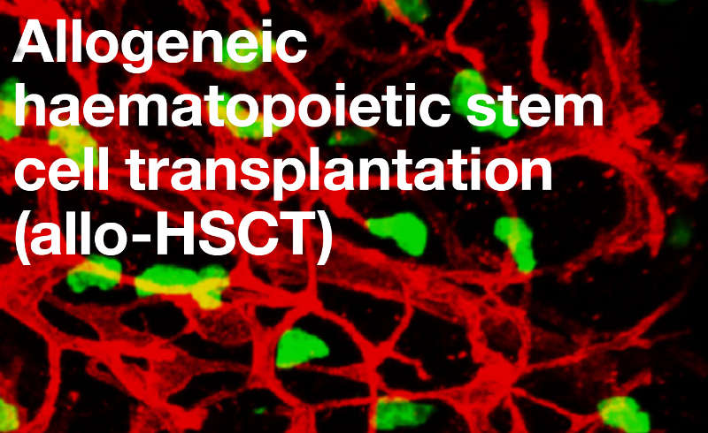 Allogeneic haematopoietic stem cell transplantation
