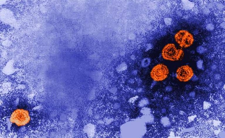 Transmission electron microscopic image of Heptatitis B virus