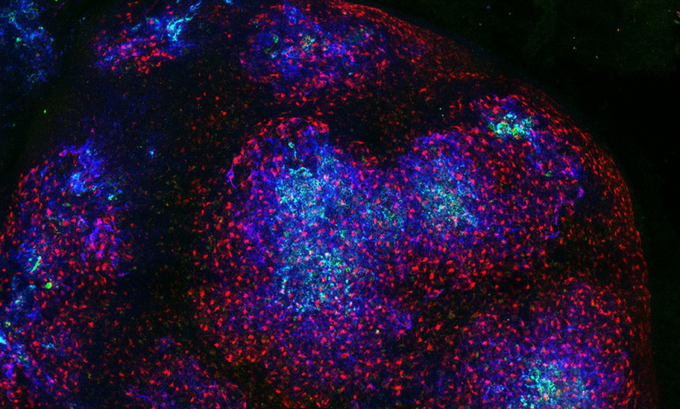 Microscope image of lymph node image of a lymph node with the Follicular Dentritic Cells in blue, all stroma in red and antigens in green.