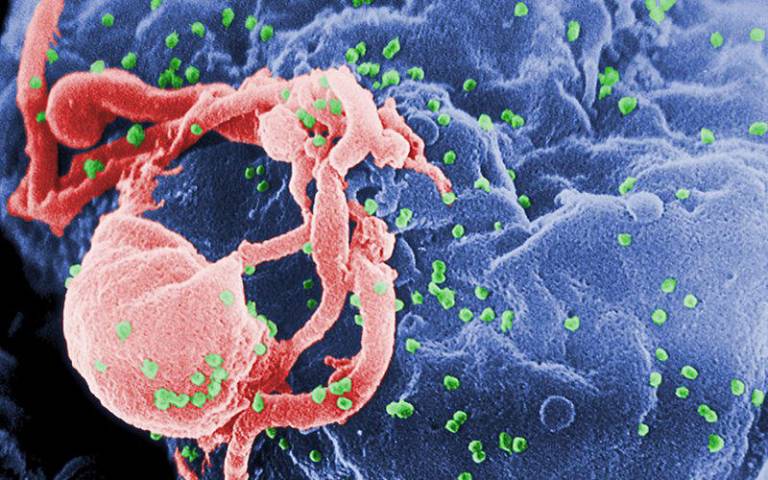 HIV budding on a lymphocyte (immune cell)