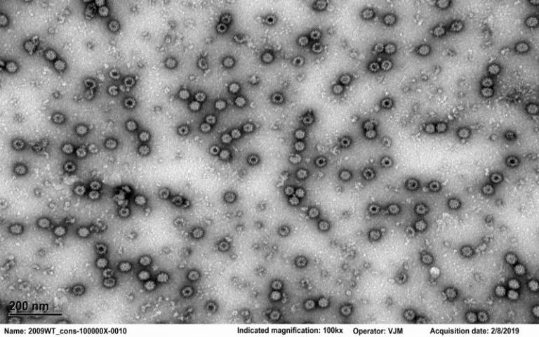 Electron micrograph of human norovirus virus like particles