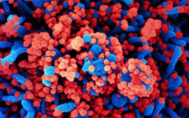 Colorized scanning electron micrograph of Novel Coronavirus SARS-CoV-2
