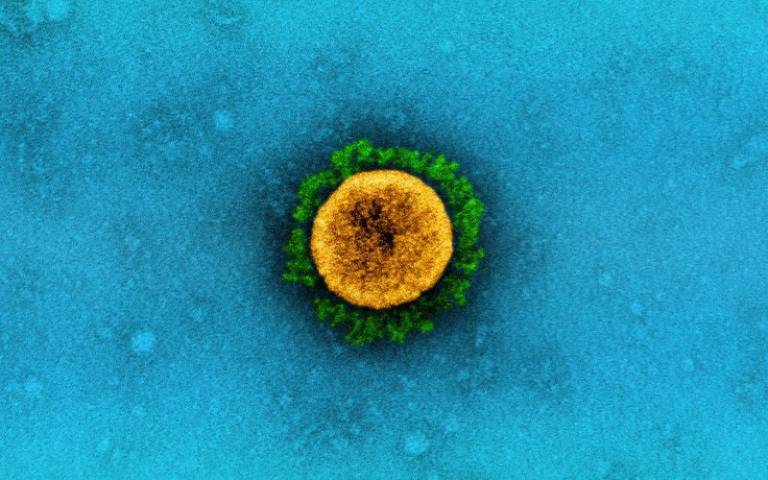 Transmission electron micrograph of a SARS-CoV-2 virus particle (UK B.1.1.7 variant), isolated from a patient sample and cultivated in cell culture
