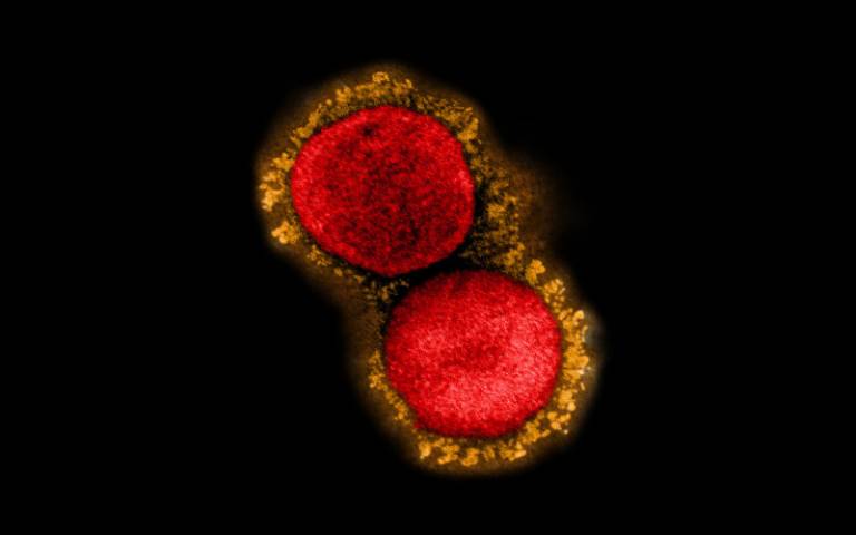 Transmission electron micrograph of SARS-CoV-2 virus particles (UK B.1.1.7 variant)