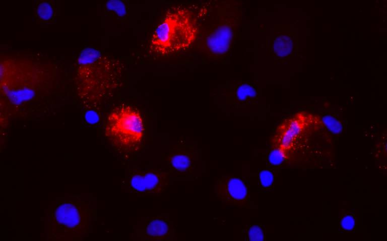 Nuclei (Blue) and IL-10 mRNA (Red) stained in primary monocyte-derived macrophages stimulated with zymosan