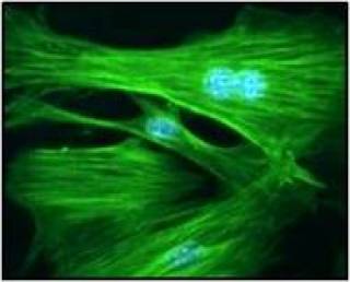 Scleroderma lung fibroblasts