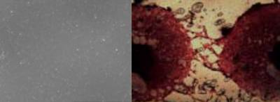 SEM image of hydroxyapatite PDLLA nanocomposite coating.jpg