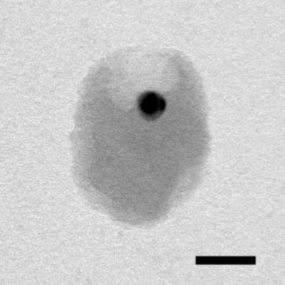 TEM tilt series of a dynamic inclusion complex of a gold nanoparticle inside a SiO2 nanocup.jpg