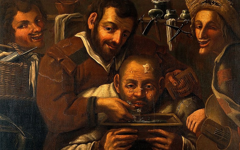 Painting of barber surgeons operating on a mans head, img credit Wellcome Trust