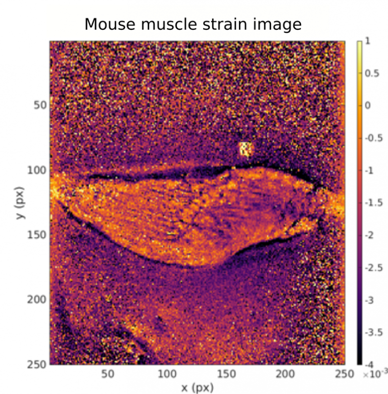 Strain image of mouse muscle obtained using optical coherence elastography and our novel strain retrieval technique. Regions of low and high strain correspond to regions of hard and soft tissue, respectively.