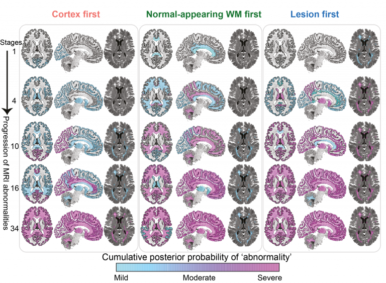 image showing brain cortex