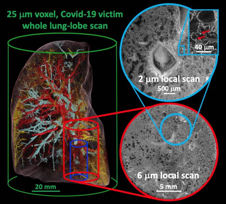 Imaging to inform models of whole organ behaviour in health and disease