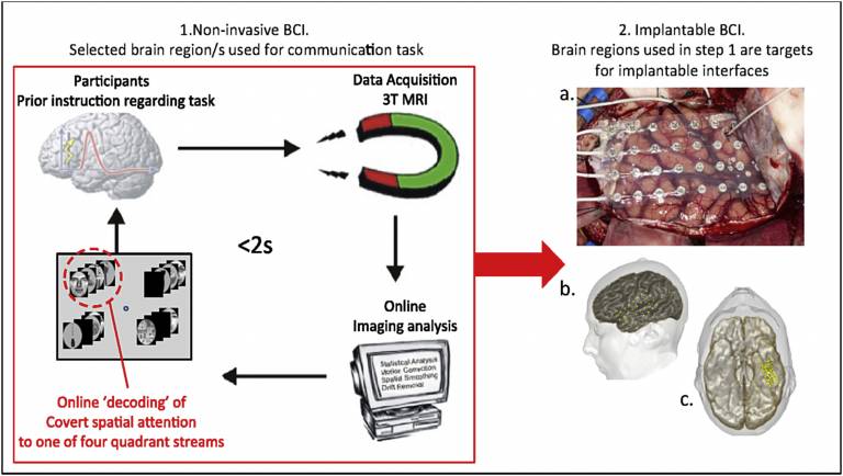 Brain-computer-interface Figure 8