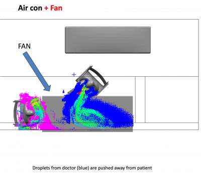 computer simulation of droplet distribution when using a fan - when placed between the doctor and patient it prevents droplet mixing 