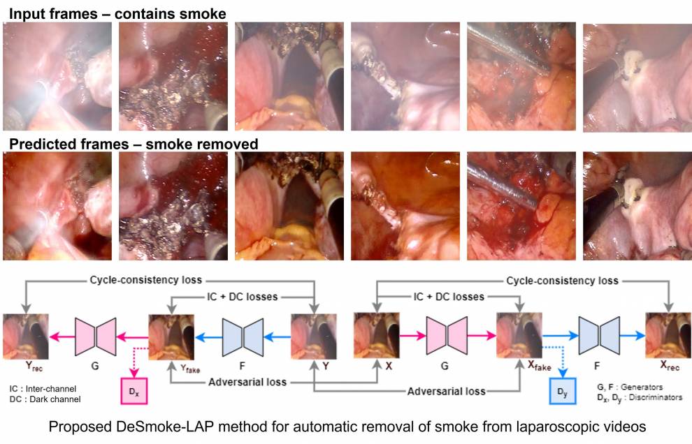 DeSmoke-LAP images of robot-assisted laparoscopic hysterectomy procedures