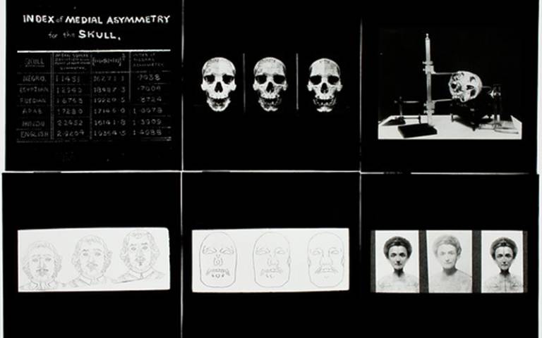 Photos of male and female faces, skulls, and anthropometric tables. Credit: UCL Imagestore, Galton Collection: GALT 400 8 lantern slides.
