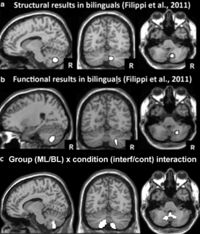 Image of brain scan of structural imaging. Filippi 2011.