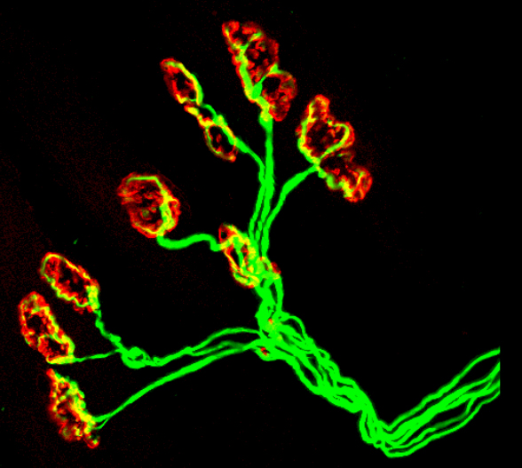 NMJ  was immunostained to visualize the axon terminal (in green) and the motor endplate (in red). Healthy NMJs indicate a high level of overlapping between both axon terminal and motor endplate