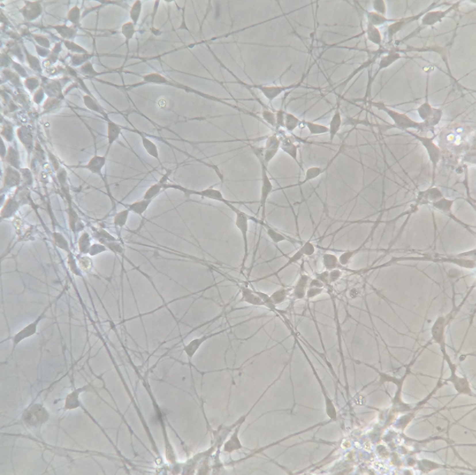ARSACS neurons