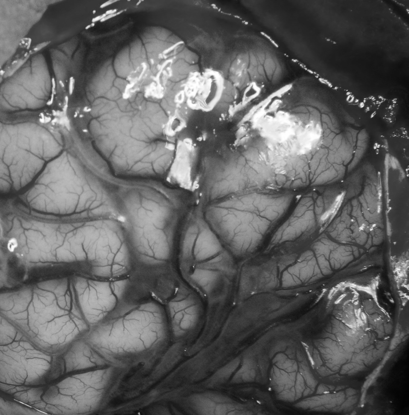 black and white image of a brain