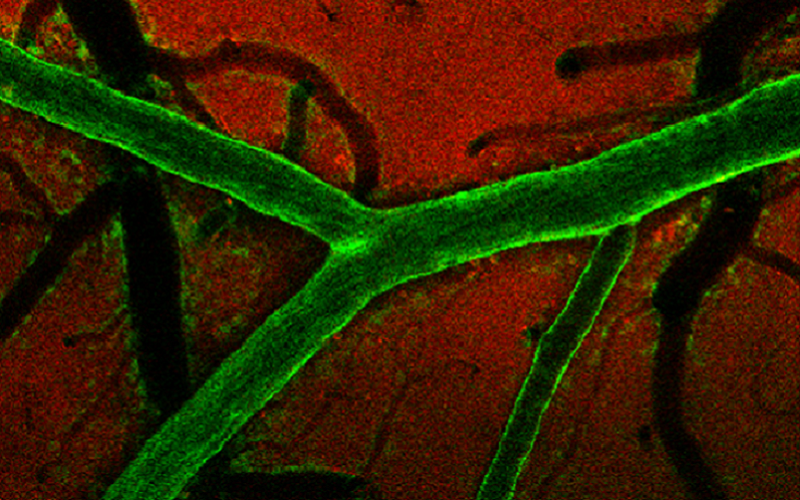 fluorescence image of blood vessel