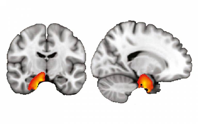 brain replay scan