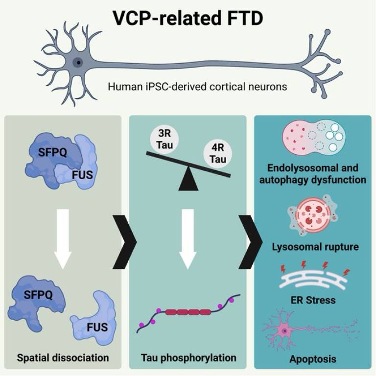 FTD neurons graphic