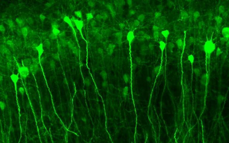cfos-GFP hippocampal neurons activated by an epileptic seizures. Credit: Benito Maffei