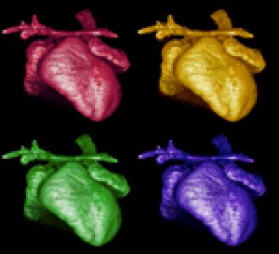 3D-reconstruction by microtomography of the heart of a Kidins220/ARMS-/- embryo