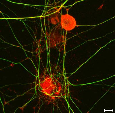 High-resolution mapping of axonal signalling endosomes