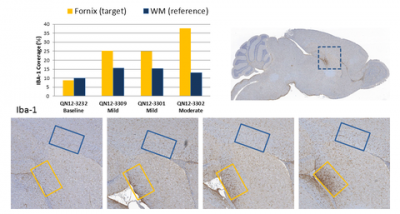 Microglia Brain Quantification