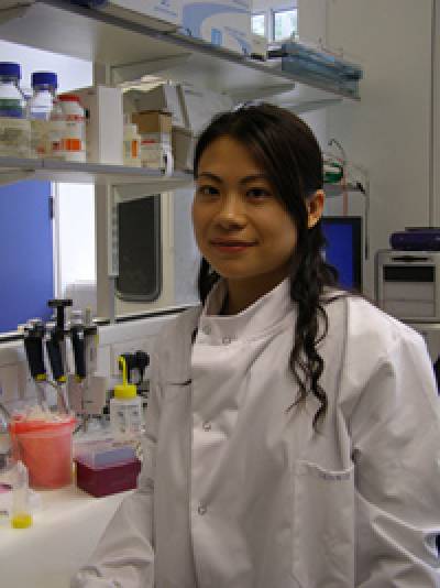 Dr Connie Luk is a postdoctoral research fellow working at SKRC on a research project, sponsored by the PSP (Europe) Association, to identify a biomarker for PSP.
