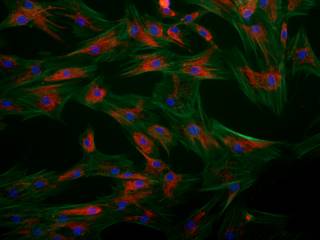 Fibroblast cells stained for cytoskeletal proteins and mitochondria