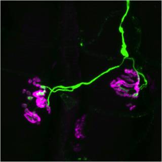 Pathological mouse neuromuscular junctions (NMJs)